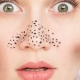 Mujer con puntos en la piel de la cara