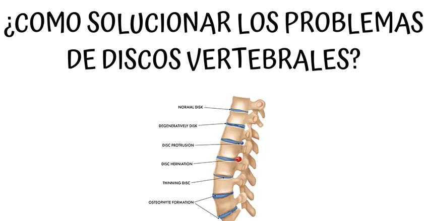 Solucionar problemas discos vertebrales PuraVida Barcelona Quiropráctico